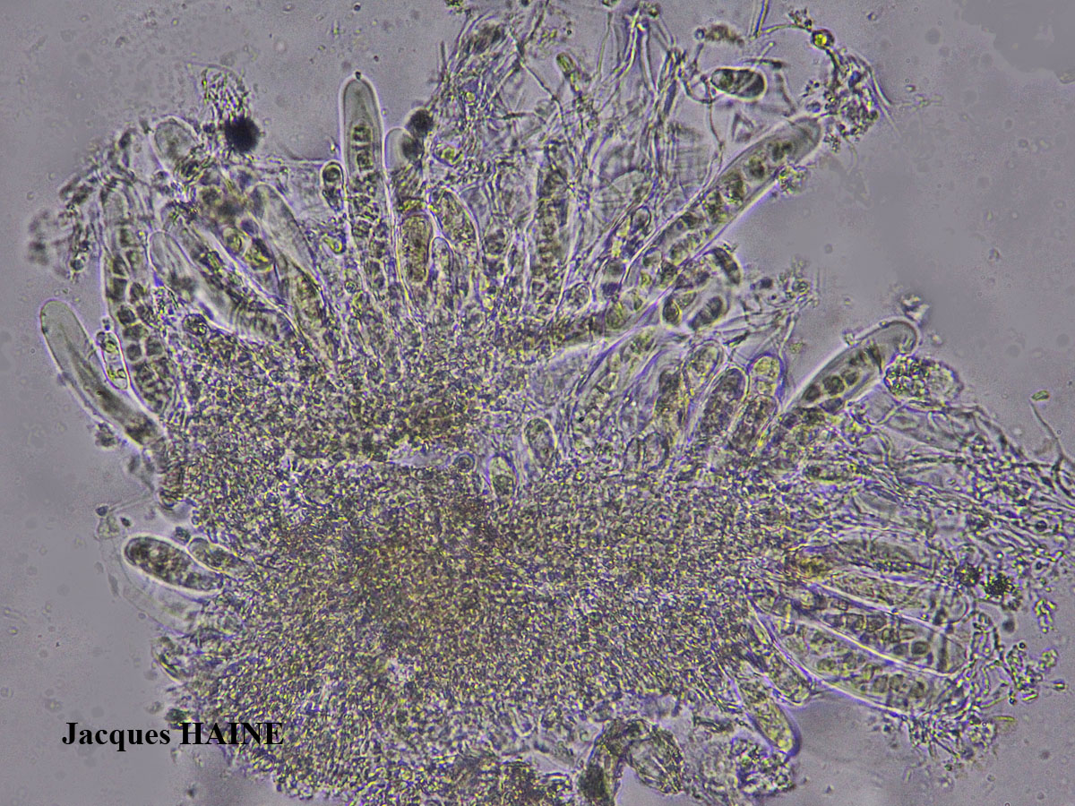 Collemopsidium ostrearum Taxon Atlantique-Manche forme sur Patella.